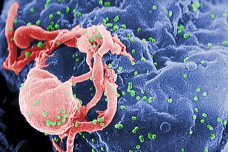 آیا HIV ممکن است در سلول های مغز خوابیده باشد؟